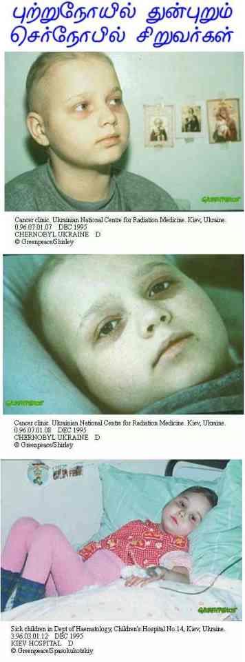 Fig 3 Chernobyl Children