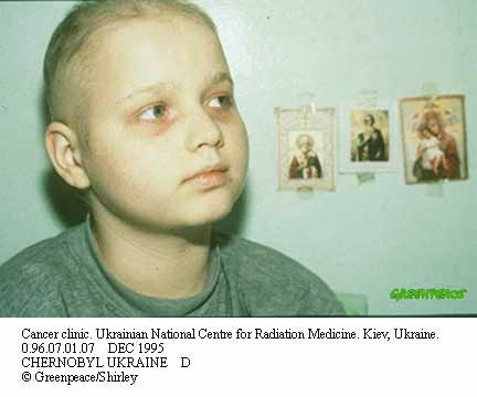 Cancer Child1